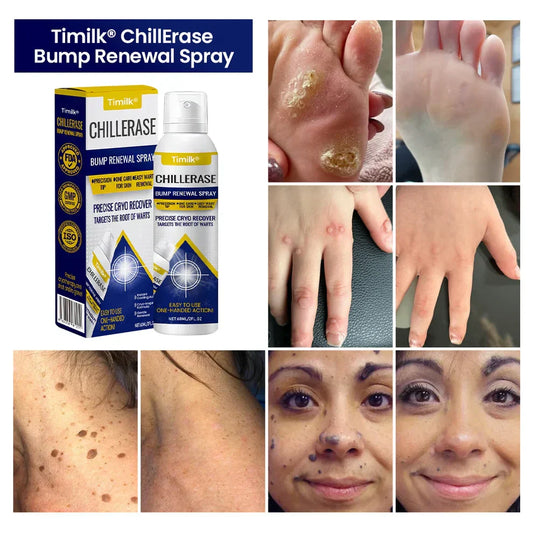 Timilk® ChillErase Bump Remowal Spray